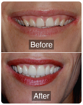 Cosmetic Dentist Smile Repair